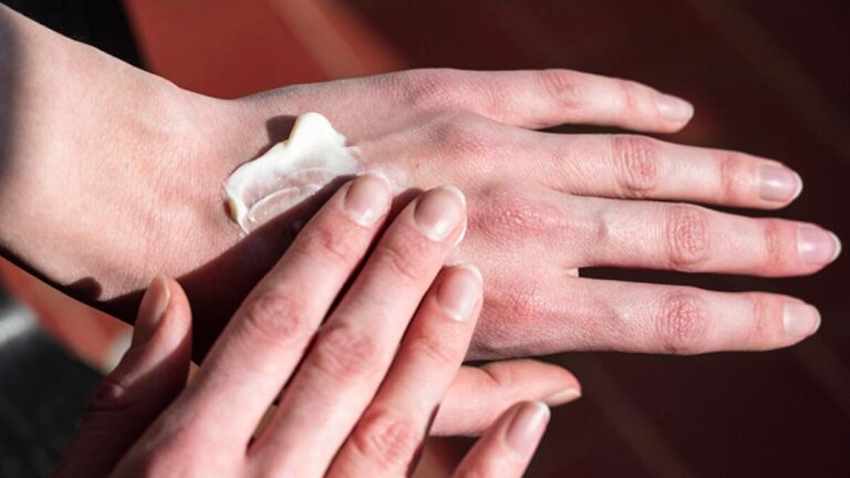 Elleriniz İçin Üstün Bakım: Kuru Elleri Anında Rahatlatan Nemlendirici Krem