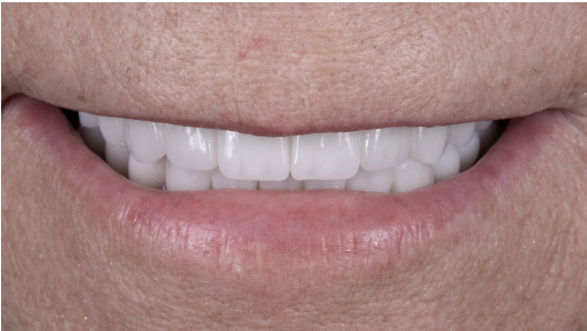 Discover Expert Dental Care with an Antalya Dentist