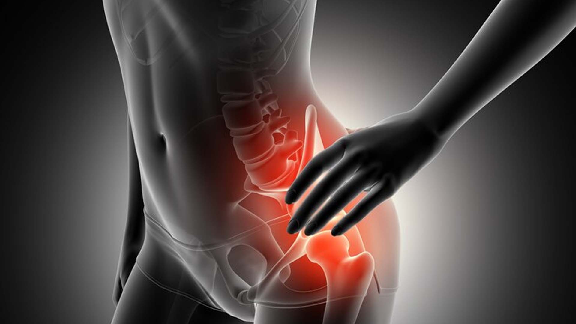 Kalça Protezi Ameliyatı